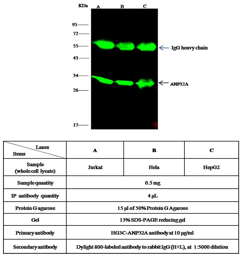 Human ANP32A / PHAP1 Immunoprecipitation(IP) 15735