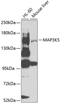 Western blot - MAP3K5 Polyclonal Antibody 