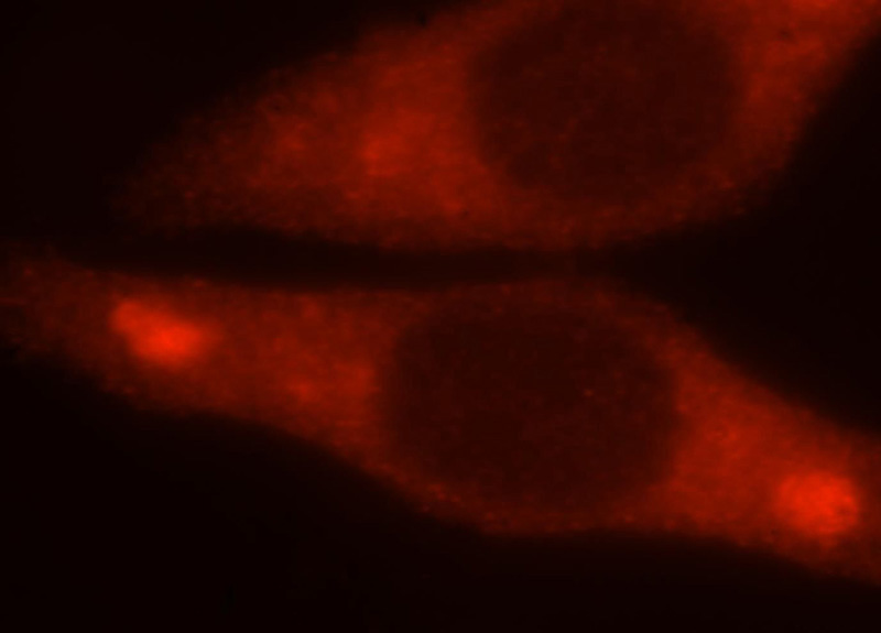 Immunofluorescent analysis of HepG2 cells, using CTPS antibody Catalog No:109728 at 1:25 dilution and Rhodamine-labeled goat anti-rabbit IgG (red).