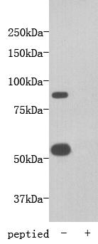 Fig1: Western blot analysis of TMEM2 on mouse heart tissue lysate using anti-TMEM2 antibody at 1/1,000 dilution.