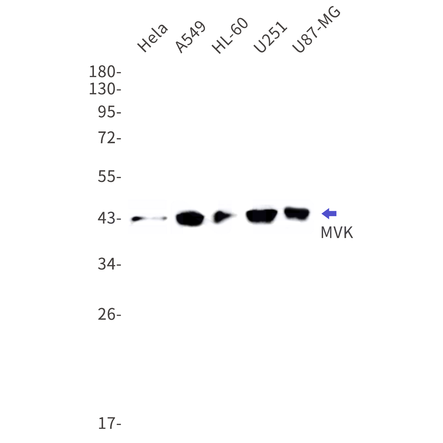 Western blot detection of MVK in Hela,A549,HL-60,U251,U87-MG cell lysates using MVK Rabbit mAb(1:1000 diluted).Predicted band size:43kDa.Observed band size:43kDa.