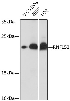 Western blot - RNF152 Polyclonal Antibody 