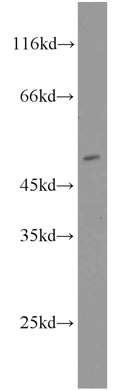 A2780 cells were subjected to SDS PAGE followed by western blot with Catalog No:109682(CYP19A1 antibody) at dilution of 1:1000