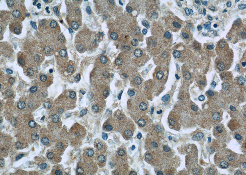 Immunohistochemistry of paraffin-embedded human liver tissue slide using Catalog No:107027(C3 Antibody) at dilution of 1:50 (under 40x lens)