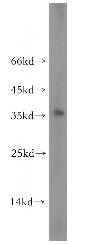 human testis tissue were subjected to SDS PAGE followed by western blot with Catalog No:116027(TGIF2LX antibody) at dilution of 1:600