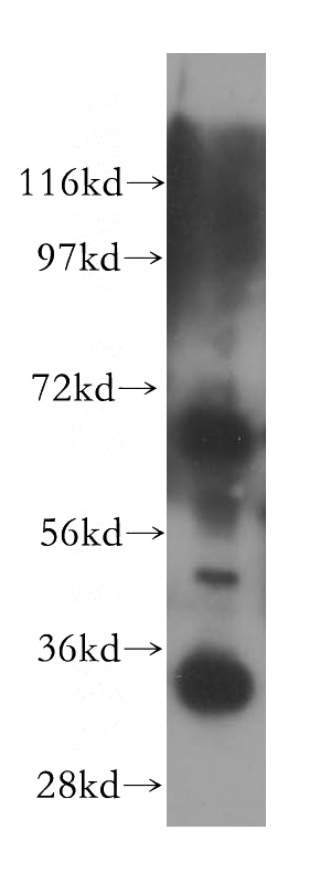 SGC-7901 cells were subjected to SDS PAGE followed by western blot with Catalog No:110234(SCYE1 antibody) at dilution of 1:500