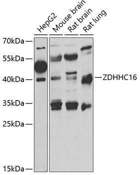 Western blot - ZDHHC16 Polyclonal Antibody 