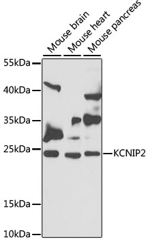 Western blot - KCNIP2 Polyclonal Antibody 