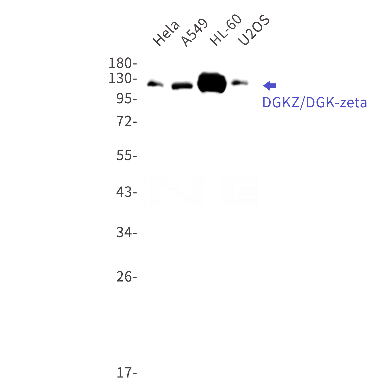 Western blot detection of DGKZ/DGK-zeta in Hela,A549,HL-60,U2OS cell lysates using DGKZ/DGK-zeta Rabbit mAb(1:1000 diluted).Predicted band size:104kDa.Observed band size:124,114kDa.