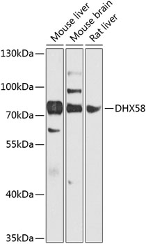 Western blot - DHX58 Polyclonal Antibody 