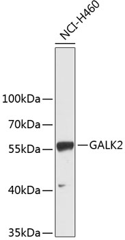 Western blot - GALK2 Polyclonal Antibody 