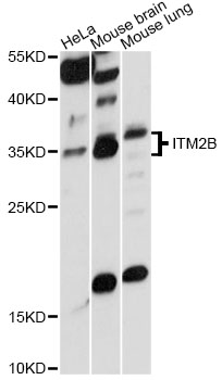 Western blot - ITM2B Polyclonal Antibody 
