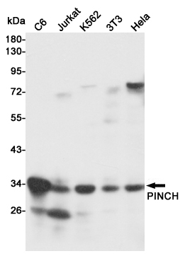Western blot detection of PINCH in C6,Jurkat,K562,3T3 and Hela cell lysates using PINCH mouse mAb (1:1000 diluted).Predicted band size:37KDa.Observed band size:35KDa.