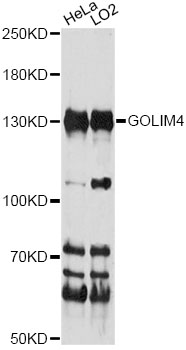 Western blot - GOLIM4 Polyclonal Antibody 