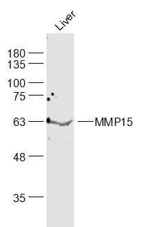 Fig1: Sample:; Liver (Mouse) Lysate at 40 ug; Primary: Anti-MMP15 at 1/1000 dilution; Secondary: IRDye800CW Goat Anti-Rabbit IgG at 1/20000 dilution; Predicted band size: 61 kD; Observed band size: 61 kD