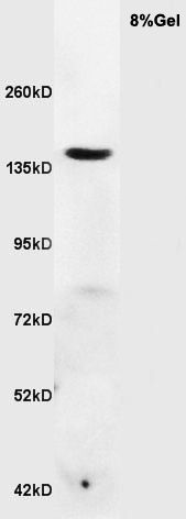 Fig3: Sample: Brain (Mouse) Lysate at 40 ug; Primary: Anti-RNF123 at 1/300 dilution; Secondary: HRP conjugated Goat-Anti-rabbit IgG (bs-0295G-HRP) at 1/5000 dilution; Predicted band size: 149 kD; Observed band size: 149 kD