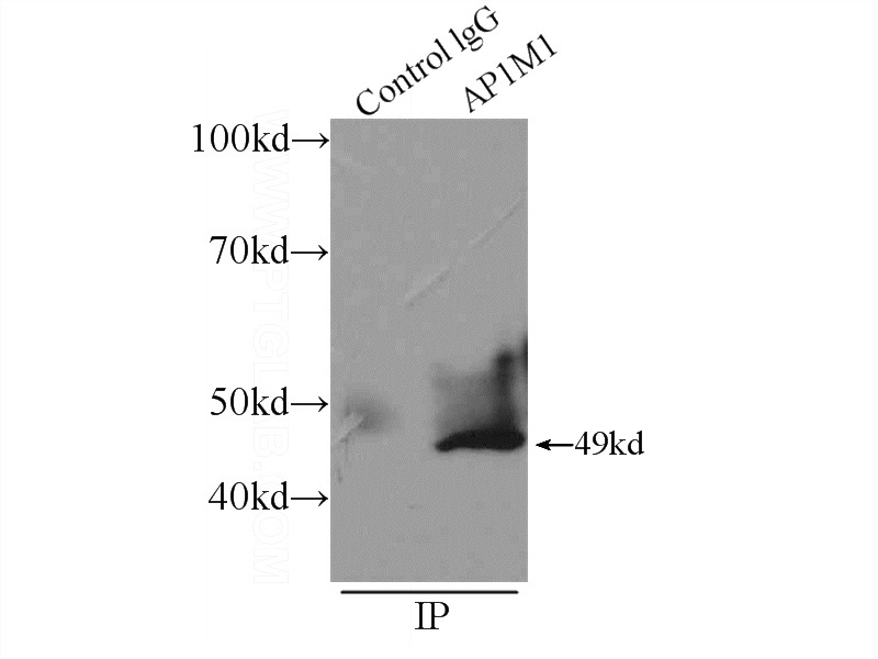 IP Result of anti-AP1M1 (IP:Catalog No:108117, 4ug; Detection:Catalog No:108117 1:500) with SH-SY5Y cells lysate 2500ug.