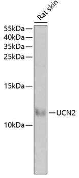 Western blot - UCN2 Polyclonal Antibody 