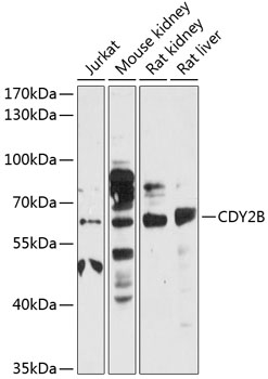 Western blot - CDY2B Polyclonal Antibody 