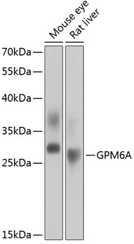 Western blot - GPM6A Polyclonal Antibody 