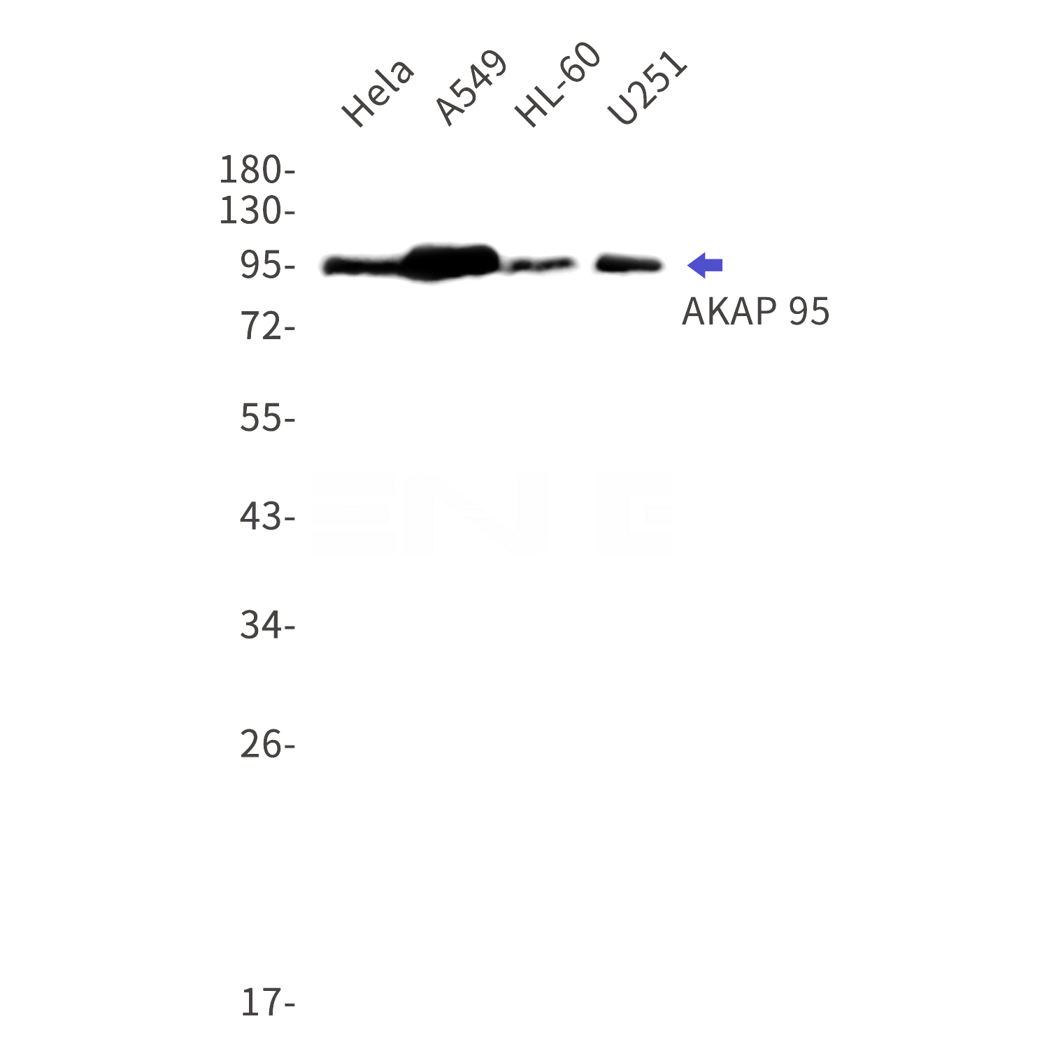 Western blot detection of AKAP 95 in Hela,A549,HL-60,U251 cell lysates using AKAP 95 Rabbit mAb(1:1000 diluted).Predicted band size:76kDa.Observed band size:95kDa.