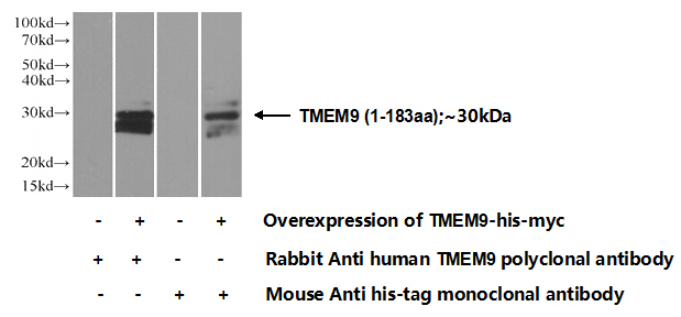 Transfected HEK-293 cells were subjected to SDS PAGE followed by western blot with Catalog No:116199(TMEM9 Antibody) at dilution of 1:700