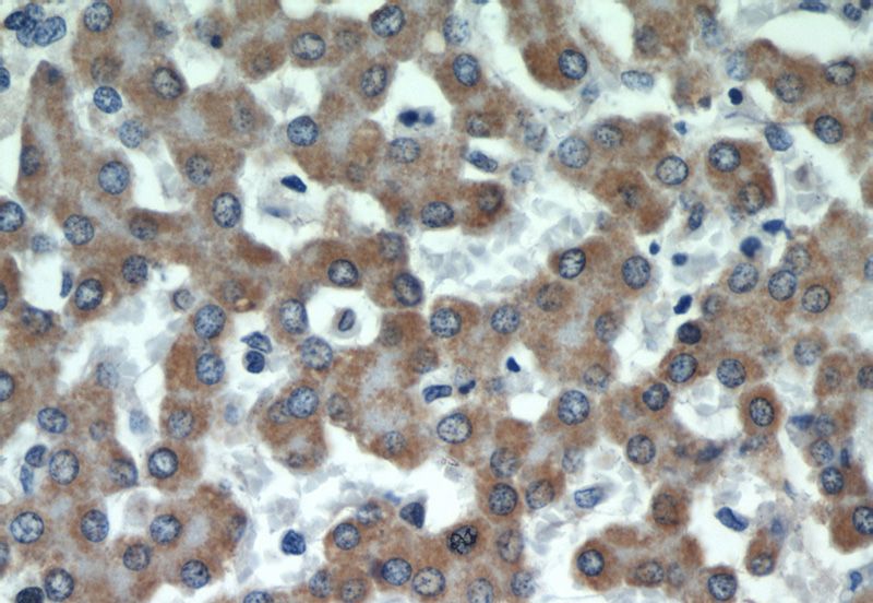 Immunohistochemical of paraffin-embedded human liver using Catalog No:109591(CSAD antibody) at dilution of 1:50 (under 40x lens)