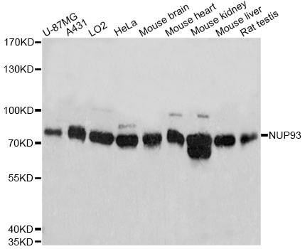 Western blot - NUP93 Polyclonal Antibody 
