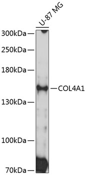 Western blot - COL4A1 Polyclonal Antibody 