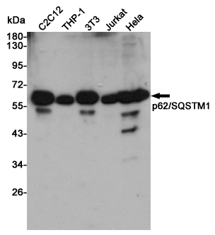 Western blot analysis of p62/SQSTM1 expression in C2C12,THP-1,3T3,Jurkat and Hela cell lysates using p62/SQSTM1 antibody at 1/1000 dilution.Predicted band size:47KDa.Observed band size:62KDa.