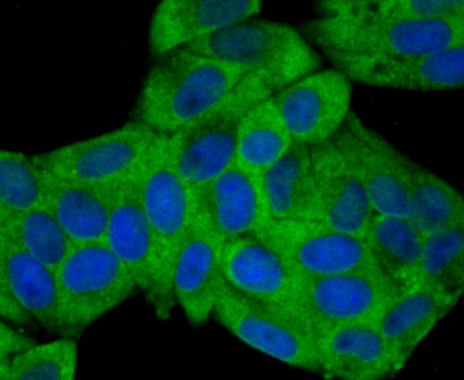 Fig2: ICC staining NaV1.7 in Hela cells (green). The nuclear counter stain is DAPI (blue). Cells were fixed in paraformaldehyde, permeabilised with 0.25% Triton X100/PBS.