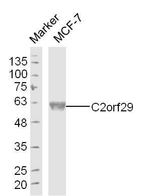 Fig1: Sample: MCF-7 Cell (Human) Lysate at 40 ug; Primary: Anti-C2orf29 at 1/300 dilution; Secondary: IRDye800CW Goat Anti-Rabbit IgG at 1/20000 dilution; Predicted band size: 55 kD; Observed band size: 55 kD