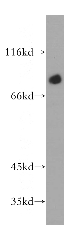 HeLa cells were subjected to SDS PAGE followed by western blot with Catalog No:113564(PALMD antibody) at dilution of 1:300
