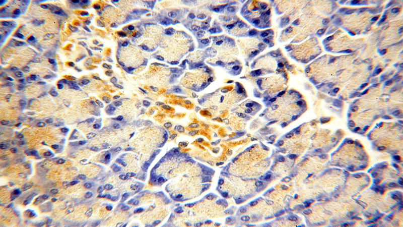Immunohistochemical of paraffin-embedded human pancreas using Catalog No:107825(ACAD10 antibody) at dilution of 1:100 (under 40x lens)