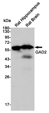 Western blot detection of GAD2 in Rat Hippocampus and Rat Brain lysates using GAD2 mouse mAb(dilution 1:1000).Predicted band size:60kDa.Observed band size:60kDa.