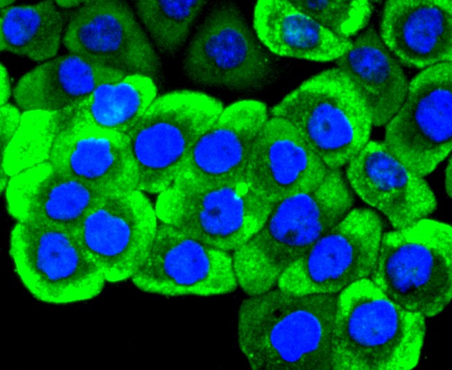 Fig2:; ICC staining of Ret in AGS cells (green). Formalin fixed cells were permeabilized with 0.1% Triton X-100 in TBS for 10 minutes at room temperature and blocked with 1% Blocker BSA for 15 minutes at room temperature. Cells were probed with the primary antibody ( 1/50) for 1 hour at room temperature, washed with PBS. Alexa Fluor®488 Goat anti-Rabbit IgG was used as the secondary antibody at 1/1,000 dilution. The nuclear counter stain is DAPI (blue).