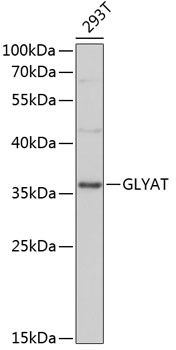 Western blot - GLYAT Polyclonal Antibody 