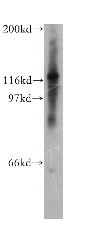 Y79 cells were subjected to SDS PAGE followed by western blot with Catalog No:109303(CHTF18 antibody) at dilution of 1:300