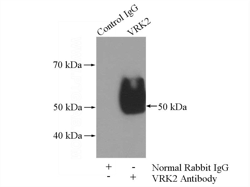 IP Result of anti-VRK2 (IP:Catalog No:116798, 4ug; Detection:Catalog No:116798 1:500) with K-562 cells lysate 3600ug.