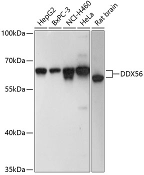 Western blot - DDX56 Polyclonal Antibody 