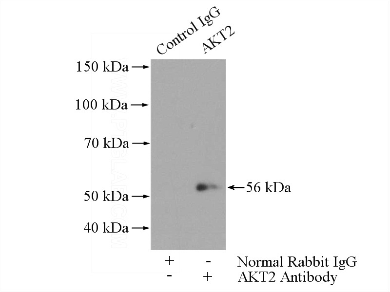 IP Result of anti-AKT2 (IP:Catalog No:107949, 4ug; Detection:Catalog No:107949 1:500) with HepG2 cells lysate 1600ug.