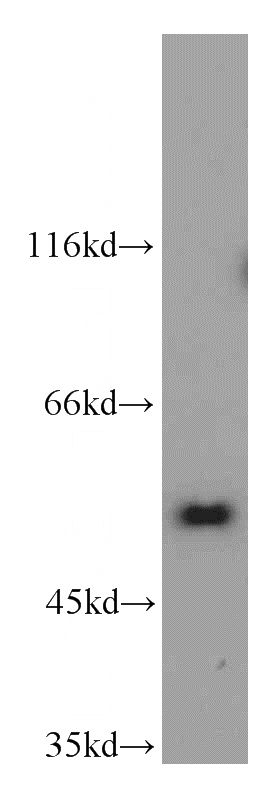 Jurkat cells were subjected to SDS PAGE followed by western blot with Catalog No:113378(NUP50 antibody) at dilution of 1:1000