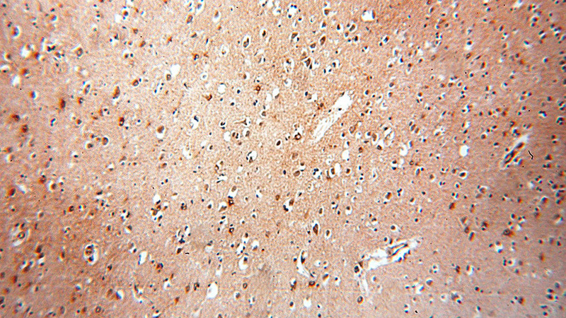 Immunohistochemical of paraffin-embedded human brain using Catalog No:115588(SRGAP3-Specific antibody) at dilution of 1:100 (under 10x lens)