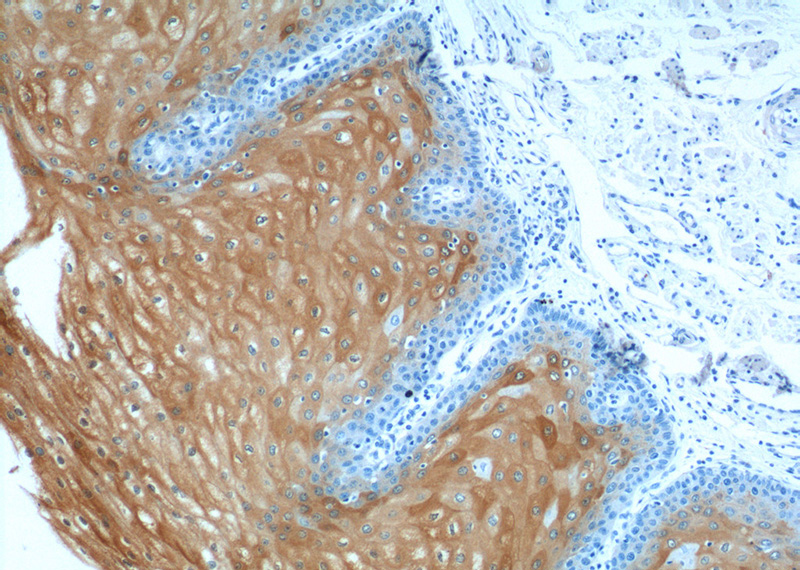 Immunohistochemistry of paraffin-embedded human oesophagus tissue slide using Catalog No:111772(IL1RN Antibody) at dilution of 1:50 (under 10x lens)