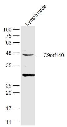 Fig1: Sample:; Lymph node (Rat) Lysate at 40 ug; Primary: Anti-C9orf140 at 1/300 dilution; Secondary: IRDye800CW Goat Anti-Rabbit IgG at 1/20000 dilution; Predicted band size: 43 kD; Observed band size: 43 kD