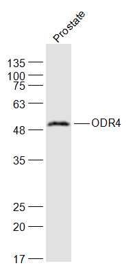Fig1: Sample:; Prostate(Rat) Lysate at 40 ug; Primary: Anti-ODR4 at 1/1000 dilution; Secondary: IRDye800CW Goat Anti-Rabbit IgG at 1/20000 dilution; Predicted band size: 51 kD; Observed band size: 51 kD
