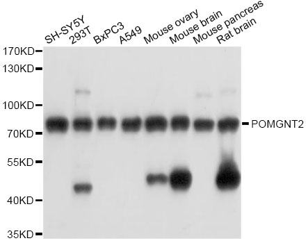 Western blot - POMGNT2 Polyclonal Antibody 