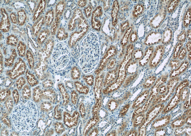 Immunohistochemistry of paraffin-embedded human kidney tissue slide using Catalog No:112671(TMEM67 Antibody) at dilution of 1:50 (under 10x lens)