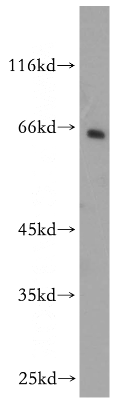 human brain tissue were subjected to SDS PAGE followed by western blot with Catalog No:109426(CNKSR3 antibody) at dilution of 1:600