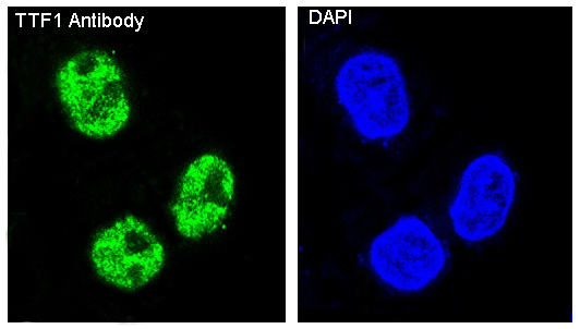 Immunofluorescent analysis of Hela cells, using TTF1 Antibody .